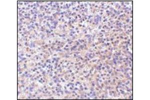 Immunohistochemistry of RP105 in human spleen tissue with this product at 10 μg/ml. (CD180 antibody  (C-Term))
