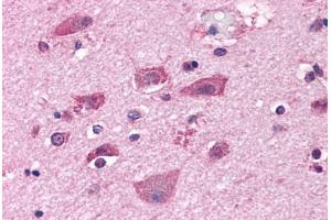 Anti-GRM7 / MGLUR7 antibody  ABIN1048943 IHC staining of human brain, neurons and glia.