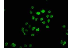 Immunofluorescence staining of Hela cells with ABIN7161945 at 1:66, counter-stained with DAPI.