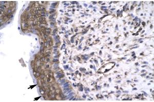 Rabbit Anti-GTF2F2 Antibody Catalog Number: ARP31437 Paraffin Embedded Tissue: Human Spermatophore Cellular Data: Epithelial cells Antibody Concentration: 4. (GTF2F2 antibody  (Middle Region))