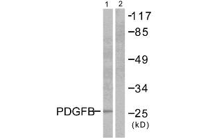 Western blot analysis of extracts from NIH/3T3 cells, using PDGFB antibody (ABIN5976488). (PDGFB antibody  (Internal Region))