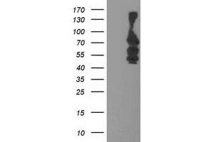 Western Blotting (WB) image for anti-Katanin P80 (WD Repeat Containing) Subunit B 1 (KATNB1) antibody (ABIN1498989)