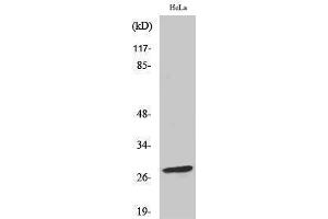 Western Blotting (WB) image for anti-B-Cell CLL/lymphoma 2 (BCL2) (pSer70) antibody (ABIN3181930) (Bcl-2 antibody  (pSer70))