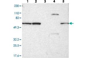 Western blot analysis of Lane 1: RT-4, Lane 2: U-251 MG, Lane 3: Human Plasma, Lane 4: Liver, Lane 5: Tonsil with SMARCD1 polyclonal antibody  at 1:250-1:500 dilution. (SMARCD1 antibody)