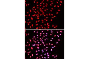 Immunofluorescence analysis of U2OS cells using B/B/SM antibody . (SMARCE1 antibody  (AA 1-411))