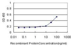 Detection limit for recombinant GST tagged SOD3 is approximately 10ng/ml as a capture antibody.