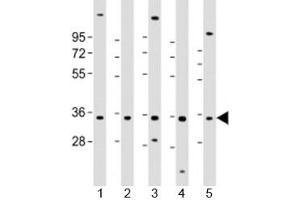 Western blot testing of human 1) HL-60, 2) K562, 3) MCF-7, 4) MOLT-4 and 5) SH-SY5Y cell lysate with PIGC antibody at 1:2000.