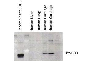 Western Blot analysis of Human cartilage lysates showing detection of SOD3 protein using Mouse Anti-SOD3 Monoclonal Antibody, Clone 4GG11G6 .