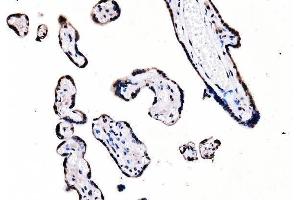 IHC analysis of splicing factor 1 using anti-splicing factor 1 antibody (ABIN7600194). (Splicing Factor 1 antibody  (AA 160-266))