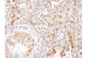 Immunohistochemistry (IHC) image for anti-CSE1 Chromosome Segregation 1-Like (CSE1L) (AA 1-50) antibody (ABIN7453909)