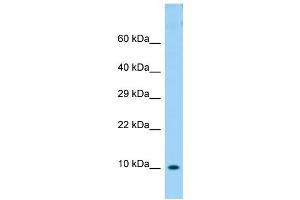 Host: Rabbit Target Name: COX6B1 Sample Type: OVCAR-3 Whole Cell lysates Antibody Dilution: 1. (COX6B1 antibody  (N-Term))