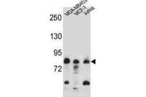 Western Blotting (WB) image for anti-AFG3-Like Protein 2 (AFG3L2) antibody (ABIN2997215) (AFG3L2 antibody)