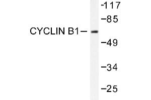 Image no. 1 for anti-Cyclin B1 (CCNB1) antibody (ABIN271880) (Cyclin B1 antibody)