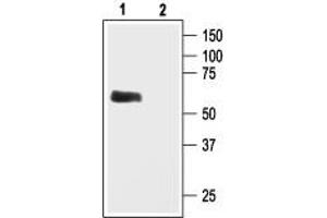Western blot analysis of rat brain membranes: - 1.
