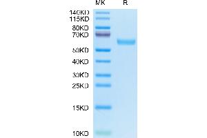 CD7 Protein (CD7) (AA 26-180) (Fc Tag)