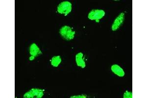 IF analysis of EWSR1 using anti-EWSR1 antibody (ABIN3043825). (EWSR1 antibody  (Middle Region))