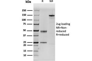 SDS-PAGE Analysis Purified Dystrophin Monospecific Mouse Monoclonal Antibody (DMD/3243).