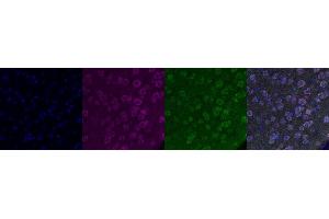 Immunohistochemistry (IHC) image for anti-Transient Receptor Potential Cation Channel, Subfamily C, Member 6 (TRPC6) antibody (ABIN7456114) (TRPC6 antibody)