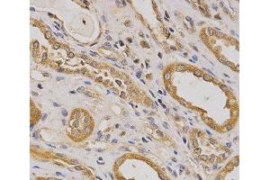 Immunohistochemistry of paraffin-embedded Human kidney using ARHGAP25 Polyclonal Antibody at dilution of 1:200 (40x lens). (ARHGAP25 antibody)