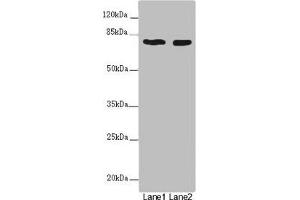 Western blot All lanes: UVRAG antibody at 2 μg/mL Lane 1: SH-SY5Y whole cell lysate Lane 2: 293T whole cell lysate Secondary Goat polyclonal to rabbit IgG at 1/10000 dilution Predicted band size: 79, 36 kDa Observed band size: 79 kDa (UVRAG antibody  (AA 375-425))