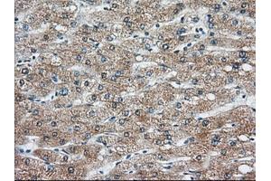 Immunohistochemical staining of paraffin-embedded Human liver tissue using anti-KHK mouse monoclonal antibody.