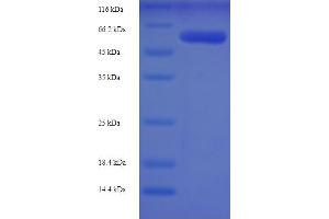 SDS-PAGE (SDS) image for Adenosylhomocysteinase (AHCY) (AA 2-432) protein (His-SUMO Tag) (ABIN5709017) (AHCY Protein (AA 2-432) (His-SUMO Tag))