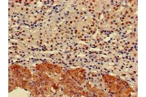 Immunohistochemistry of paraffin-embedded human adrenal gland tissue using ABIN7151526 at dilution of 1:100 (ELMOD2 antibody  (AA 82-200))