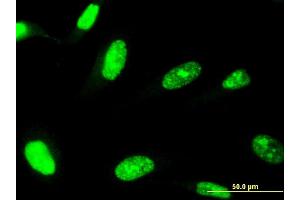 Immunofluorescence of monoclonal antibody to ZNF81 on HeLa cell. (ZNF81 antibody  (AA 1-122))
