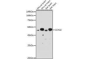 Western blot analysis of extracts of various cell lines, using SOX10 antibody (ABIN7270568) at 1:500 dilution. (SOX10 antibody  (AA 200-300))