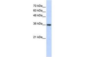 Image no. 1 for anti-Aldo-Keto Reductase Family 7, Member A3 (Aflatoxin Aldehyde Reductase) (AKR7A3) (AA 179-228) antibody (ABIN6743260) (AKR7A3 antibody  (AA 179-228))