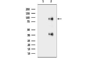 anti-Cation Channel, Sperm Associated 1 (CATSPER1) (N-Term) antibody