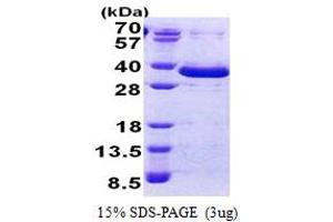 SDS-PAGE (SDS) image for Family with Sequence Similarity 84, Member A (FAM84A) (AA 1-292) protein (His tag) (ABIN5853108)
