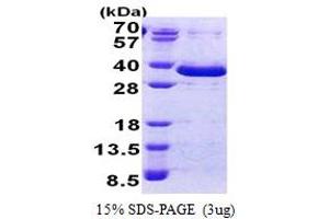SDS-PAGE (SDS) image for Family with Sequence Similarity 84, Member A (FAM84A) (AA 1-292) protein (His tag) (ABIN5853108) (FAM84A Protein (AA 1-292) (His tag))
