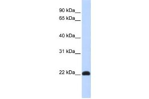 Western Blotting (WB) image for anti-Kruppel-Like Factor 16 (KLF16) antibody (ABIN2458429)
