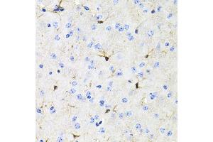Immunohistochemistry of paraffin-embedded mouse brain using ACVR2A antibody (ABIN5971030) at dilution of 1/100 (40x lens). (ACVR2A antibody)