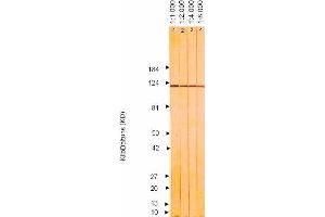 Western Blotting (WB) image for anti-Herpes Simplex Virus Type 2 ICP8 (HSV2 ICP8) antibody (ABIN265566) (HSV2 ICP8 antibody)