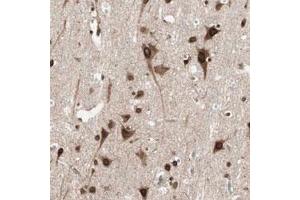 Immunohistochemical staining (Formalin-fixed paraffin-embedded sections) of human cerebral cortex with NUP62 polyclonal antibody  shows strong nuclear membrane and cytoplasmic positivity in neuronal cells. (NUP62 antibody)