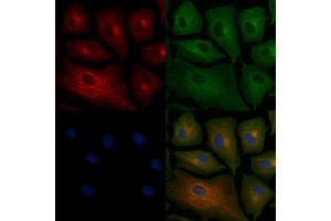 ABIN6258567 and ABIN6276236 staining  cells by IF/ICC.