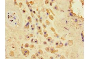 Immunohistochemistry of paraffin-embedded human placenta tissue using ABIN7154826 at dilution of 1:100 (TSC1 antibody  (AA 101-344))