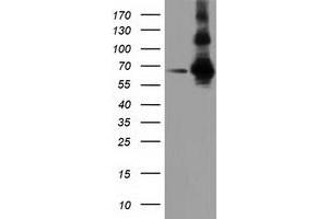 HEK293T cells were transfected with the pCMV6-ENTRY control (Left lane) or pCMV6-ENTRY ZIM2 (Right lane) cDNA for 48 hrs and lysed. (ZIM2 antibody  (AA 1-150, AA 428-527))