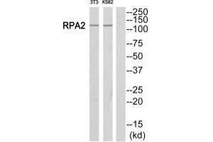 Western blot analysis of extracts from Jurkat/NIH-3T3 cells, using POLR1B antibody. (POLR1B antibody  (C-Term))