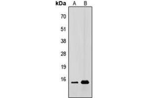 Western blot analysis of CDC42EP5 expression in HEK293T (A), A431 (B) whole cell lysates.