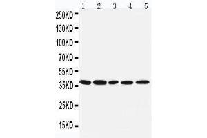 Anti-IRF1 antibody, Western blotting Lane 1: COLO320 Cell Lysate Lane 2: U87 Cell Lysate Lane 3: HELA Cell Lysate Lane 4: JURKAT Cell Lysate Lane 5: MCF-7 Cell Lysate