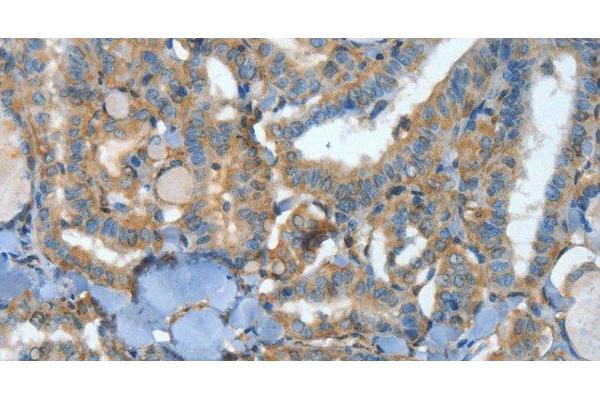 ATP4b antibody