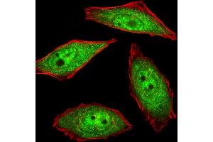 Fluorescent image of U251 cells stained with hNEK2-C410 . (NEK2 antibody  (AA 396-426))