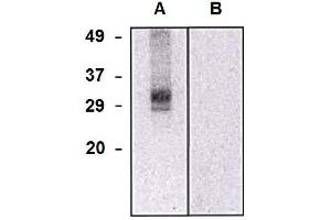 CLIC5 anticorps  (AA 160-173)