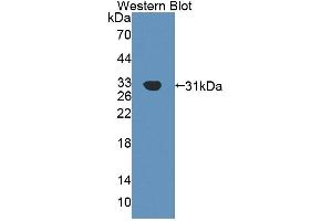 Detection of Recombinant Agrin, Human using Polyclonal Antibody to Agrin (AGRN) (AGRN antibody  (AA 1329-1548))