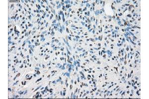 Immunohistochemical staining of paraffin-embedded pancreas tissue using anti-LTA4H mouse monoclonal antibody. (LTA4H antibody)