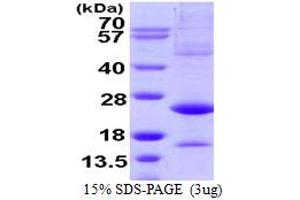 SDS-PAGE (SDS) image for Activating Transcription Factor 3 (ATF3) (AA 1-181) protein (ABIN667497)
