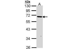 WB Image Sample (30 ug of whole cell lysate) A: A431 , 10% SDS PAGE antibody diluted at 1:1000 (JMJD6 antibody  (Center))